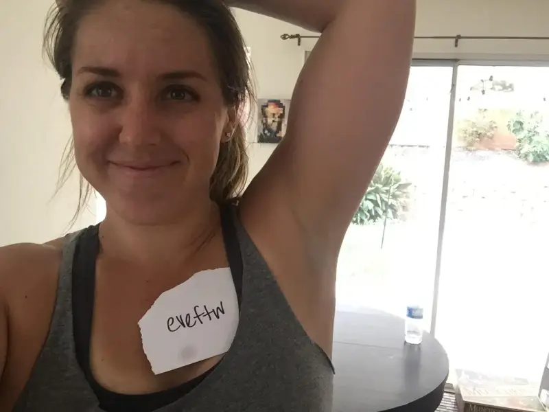 Kvinna visar sin armhåla, som har viss hyperpigmentering. En lapp med texten "eveftw" sitter på hennes bröst.